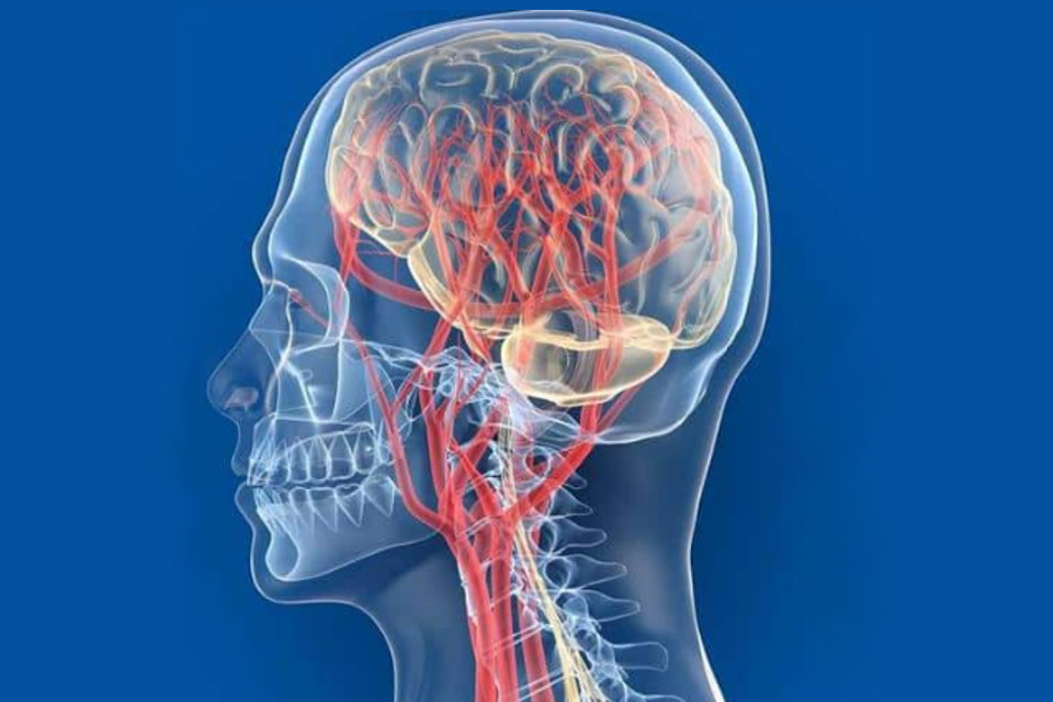 Як покращити мозковий кровообіг: причини порушень і ефективні рішення